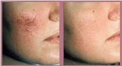 cosmetic dermatologist toronto